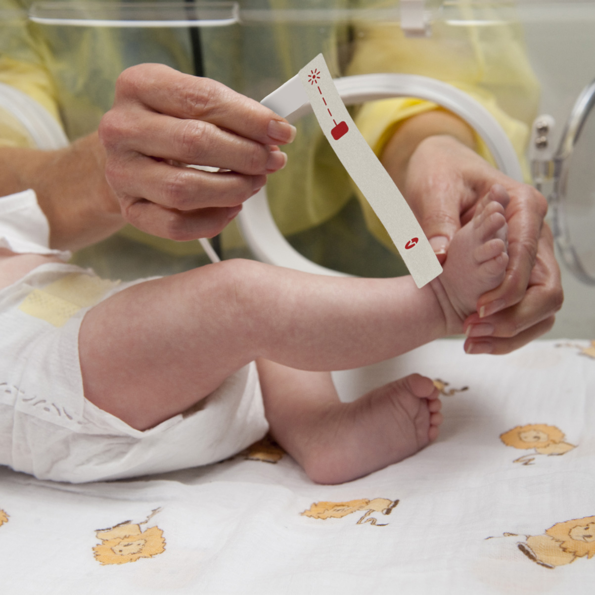 Nourrisson en couveuse dans une unité de soins intensifs néonatals d'un hôpital avec un médecin appliquant un capteur d'oxymétrie de pouls Masimo. 